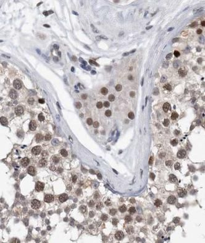 RSRC1 Rabbit Polyclonal Antibody