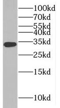 RSU1 Rabbit Polyclonal Antibody
