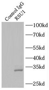 RSU1 Rabbit Polyclonal Antibody