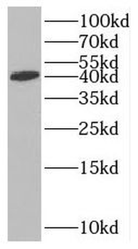 RTCA Antibody