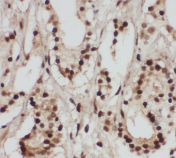 RTF1 Rabbit Polyclonal Antibody