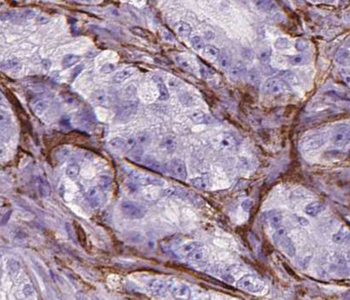 RTKN Rabbit Polyclonal Antibody