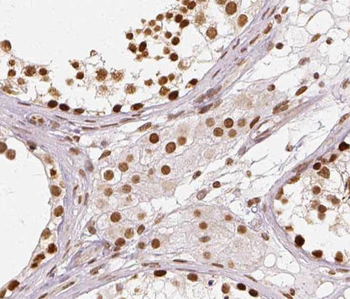 RUNDC3A Rabbit Polyclonal Antibody