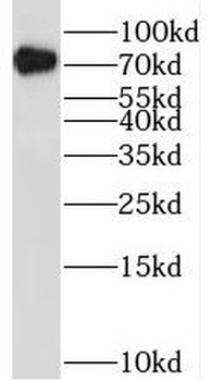 RUNX1T1 Antibody