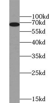 RYK Antibody
