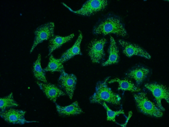 RYK Rabbit Polyclonal Antibody