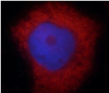 S100A6 Rabbit Polyclonal Antibody