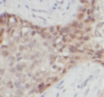 S100B Rabbit Polyclonal Antibody