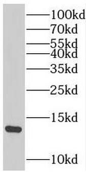 SAA1 Antibody