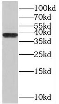 SAE1 Rabbit Polyclonal Antibody