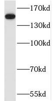 SAFB Antibody