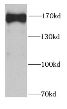 SAFB2 Rabbit Polyclonal Antibody