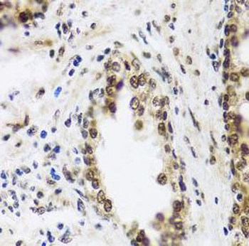 SAFB2 Rabbit Polyclonal Antibody