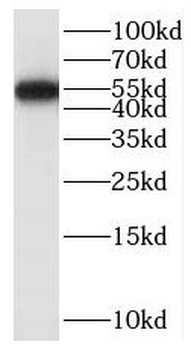 SAMD14 Rabbit Polyclonal Antibody