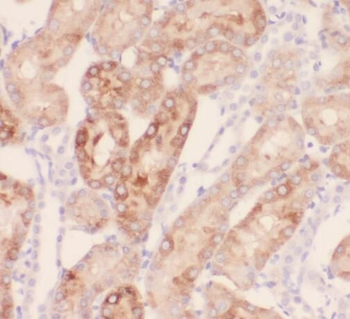 SAMD14 Rabbit Polyclonal Antibody