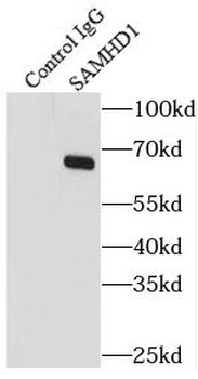 SAMHD1 Rabbit Polyclonal Antibody