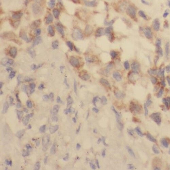 SAMHD1 Rabbit Polyclonal Antibody