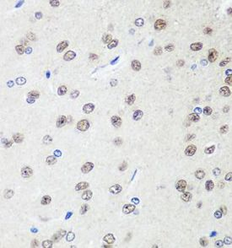 SAP18 Rabbit Polyclonal Antibody
