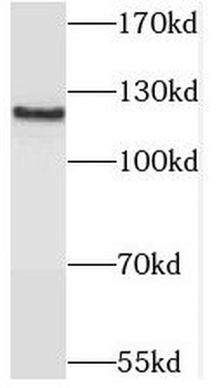 PPP6R1 Antibody