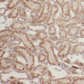 PPP6R3 Rabbit Polyclonal Antibody