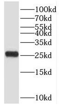 SAR1B Rabbit Polyclonal Antibody