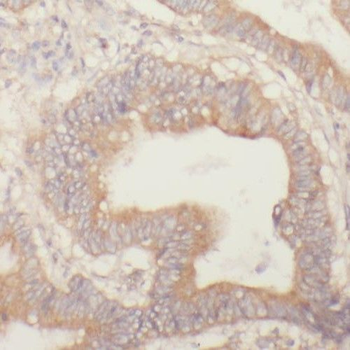 SAR1B Rabbit Polyclonal Antibody