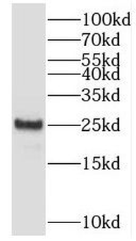 SAR1B Rabbit Polyclonal Antibody