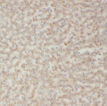 SAR1B Rabbit Polyclonal Antibody