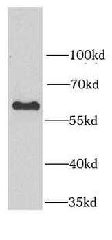 SARS1 Antibody