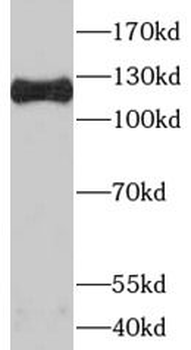 SART3 Antibody