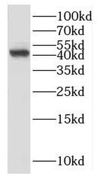SCARA5 Antibody