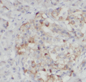 SCMH1 Rabbit Polyclonal Antibody