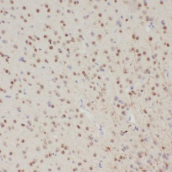 SCNM1 Antibody
