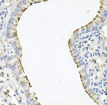 SCNN1G Rabbit Polyclonal Antibody