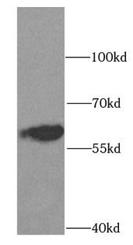 SCP2 Rabbit Polyclonal Antibody