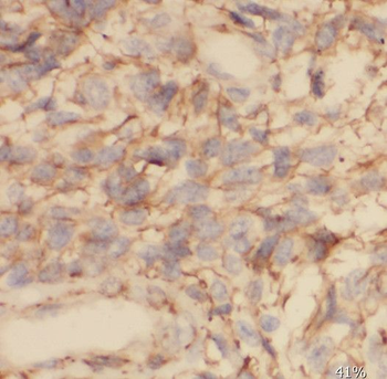 SCRN2 Rabbit Polyclonal Antibody