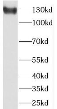SCUBE3 Antibody