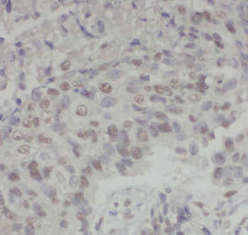 SCYL3 Rabbit Polyclonal Antibody