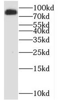 SDCCAG8 Antibody