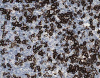 SEC24A Rabbit Polyclonal Antibody