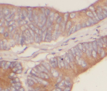 Exoc4 Rabbit Polyclonal Antibody