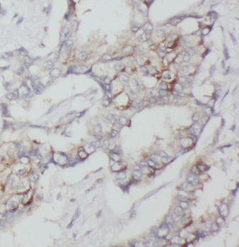 DHCR24 Rabbit Polyclonal Antibody