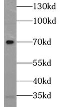 SELENON Rabbit Polyclonal Antibody