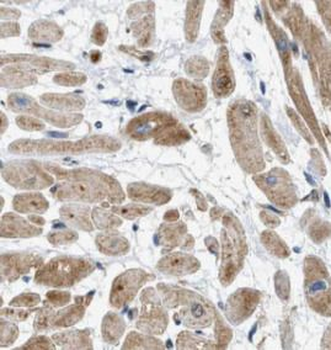 SELENON Rabbit Polyclonal Antibody