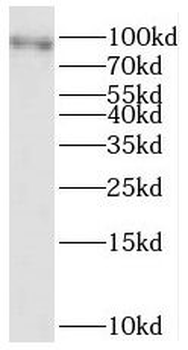 ATP2A3 Rabbit Polyclonal Antibody