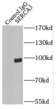 ATP2A3 Rabbit Polyclonal Antibody