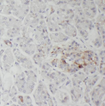 ATP2A3 Rabbit Polyclonal Antibody