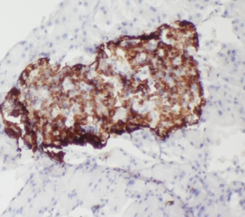 SERPINB10 Rabbit Polyclonal Antibody