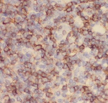 SERPING1 Rabbit Polyclonal Antibody