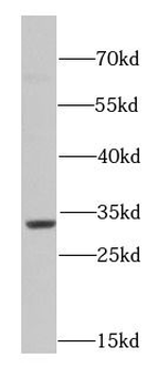 SET Rabbit Polyclonal Antibody